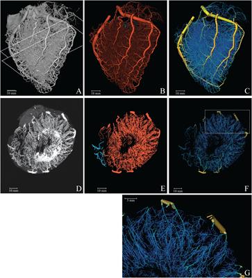 Topologic and Hemodynamic Characteristics of the Human Coronary Arterial Circulation